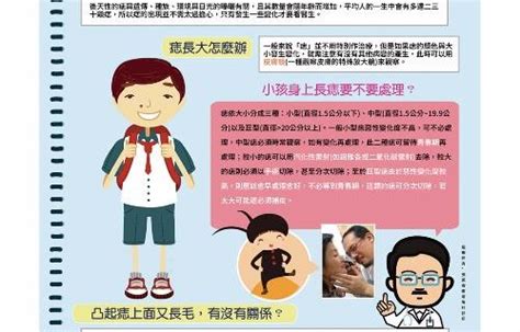 新生兒痣|小孩身上長痣要不要處理？｜正姐